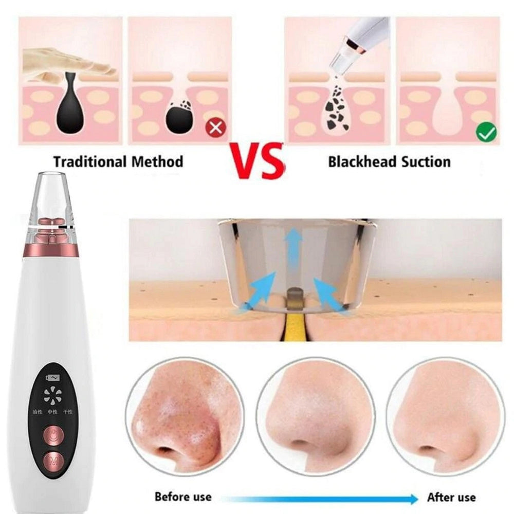 Electric Face Pores Cleaner And Blackhead Remover
