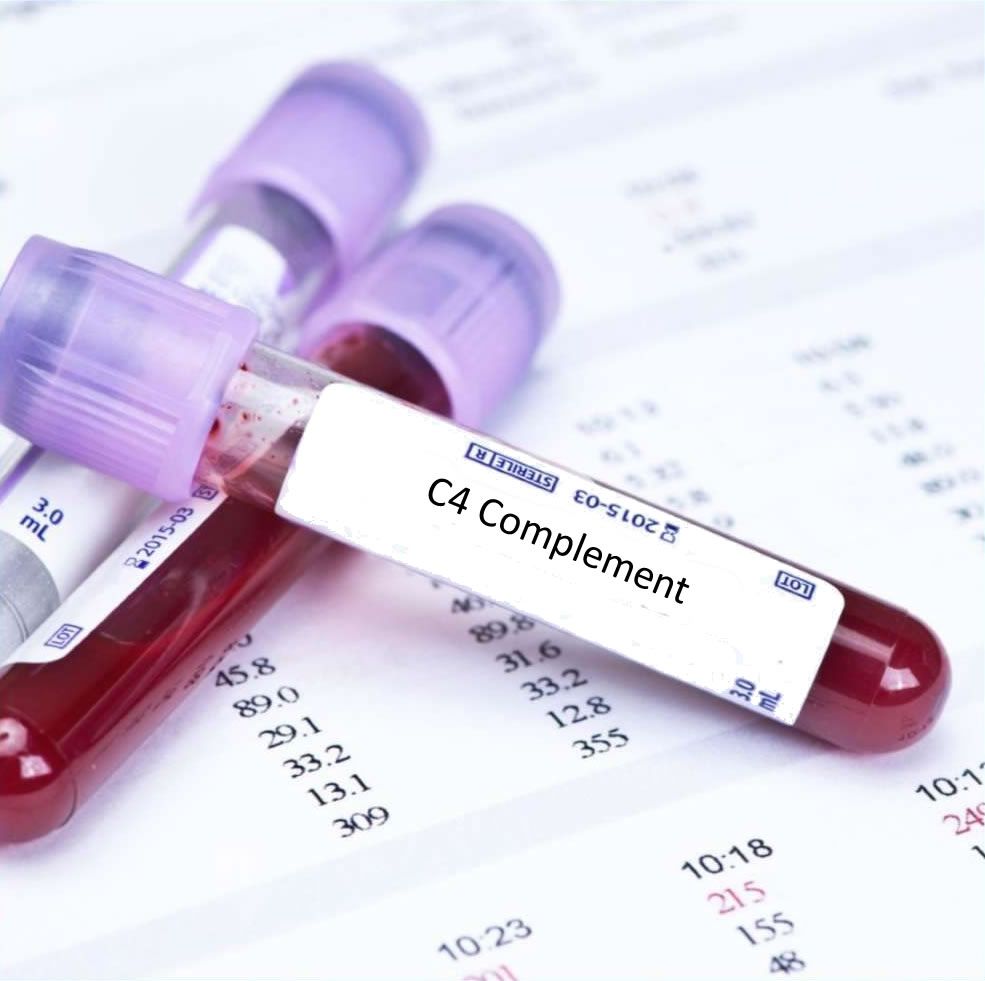 What Is C4 Complement Blood Test Low