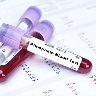 Phosphate Blood Test In London - Order Online - Attend Clinic