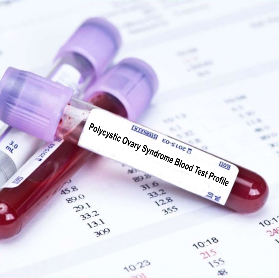 Polycystic Ovary Syndrome Blood Test Profile Blood Tests in London