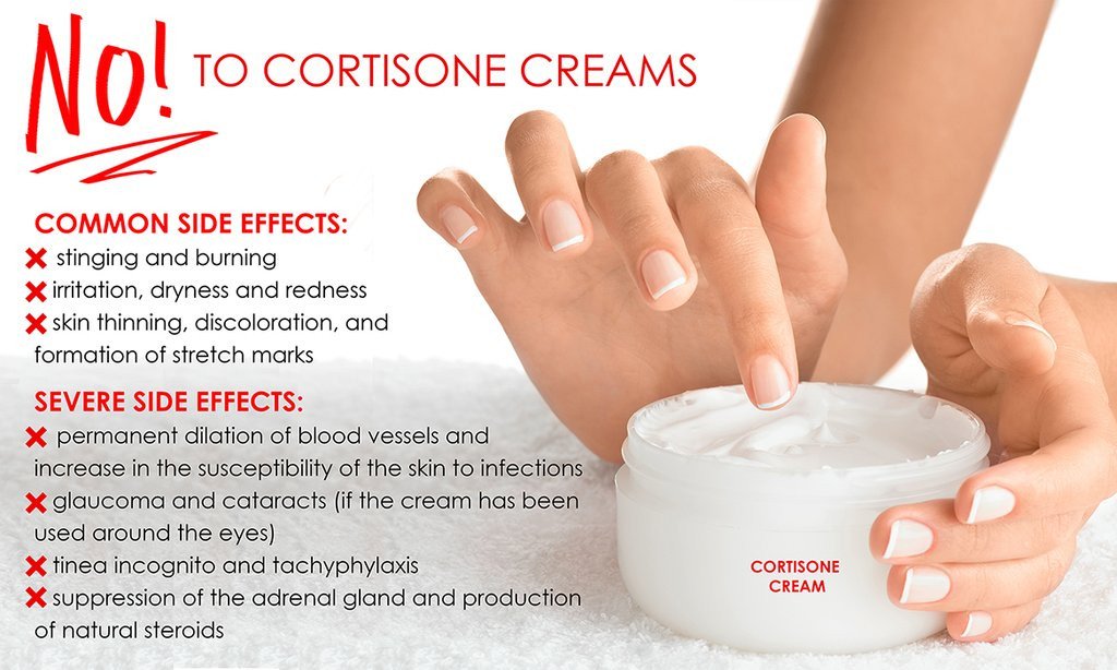 otc corticosteroid cream