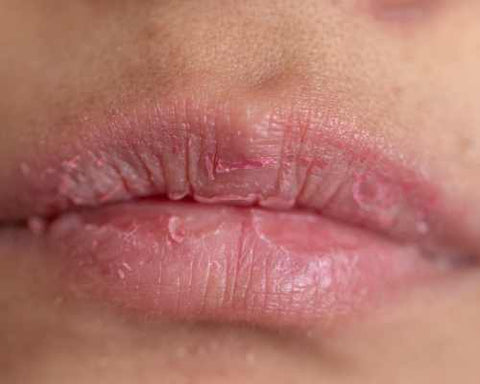 Lip oil for dry lips