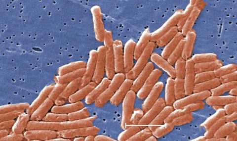 food-borne-pathogens-e-coli