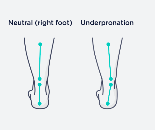 underpronation