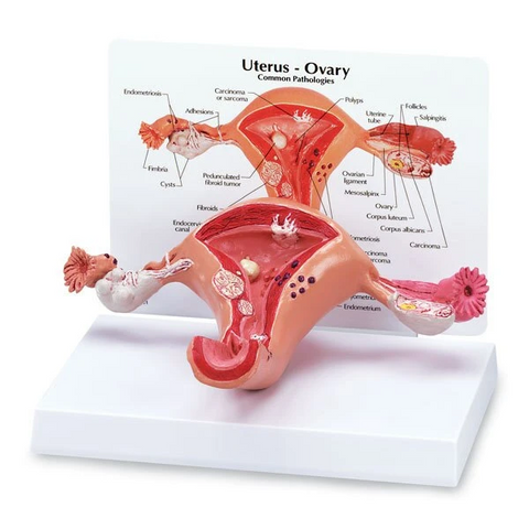 Uterus-Full Size | Nasco/Simulaids | Available from LivCor Australia