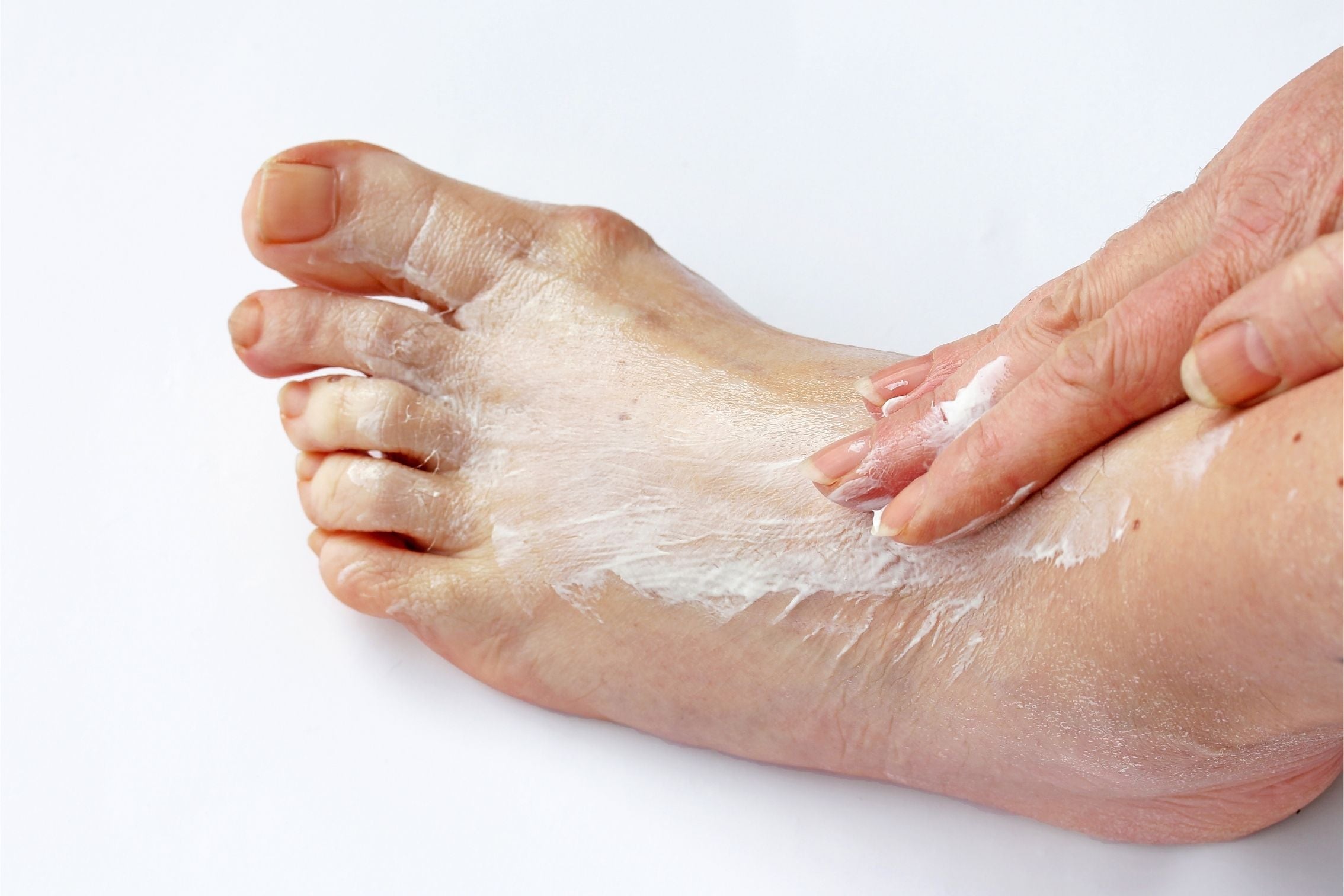 foot cream being applied
