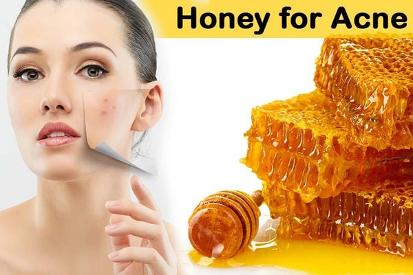 Honey in the treatment of acne scar treatment 