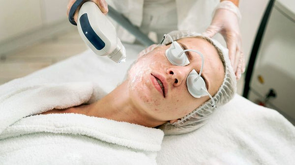 Laser therapy acne scarr treatment