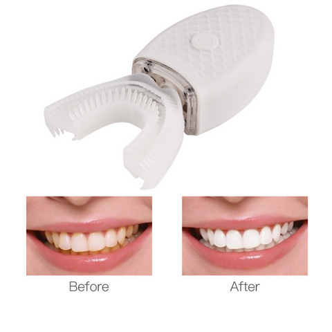 teeth-whitening-at-home