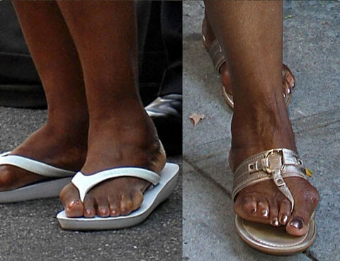 oprah_winfrey_bunions_shoes_foot_reading_large.png