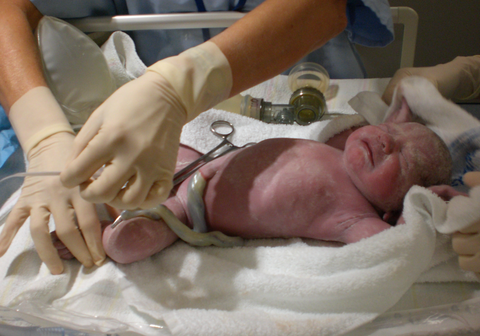 Premature Baby, Gabriel, Newborn