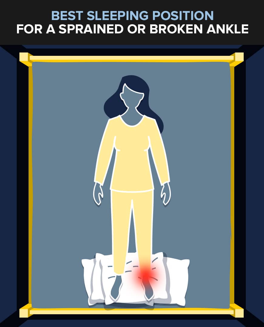 The Best Sleeping Positions For Injuries And Pain – BedPillows.com The Best Sleeping Positions For Injuries And Pain – BedPillows.com