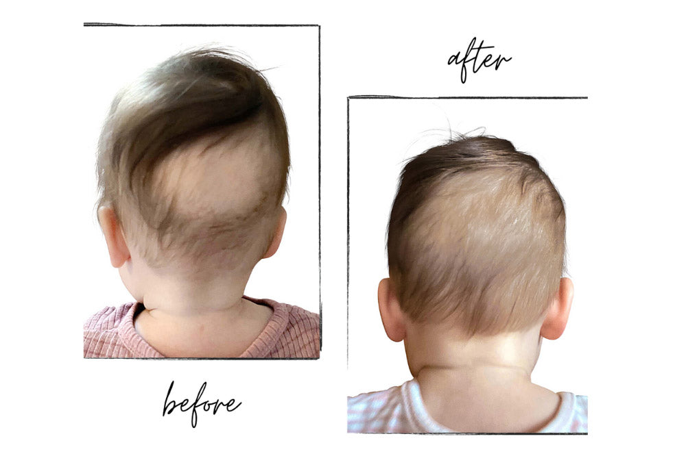 Baby hair loss When do babies lose their hair  BabyCenter