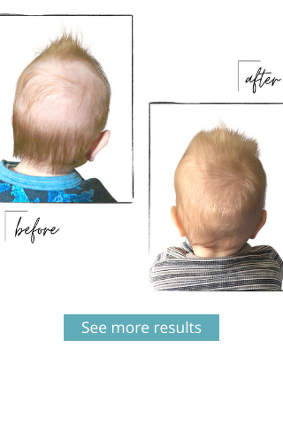 Hair Loss in Babies   Reasons  Tips to avoid Infant Hair Loss  YouTube
