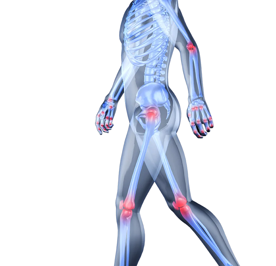 Joint Pain Quiz online free
