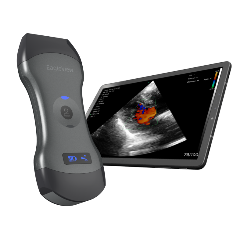 Handheld dualhead wireless ultrasound machine, premium quality medical