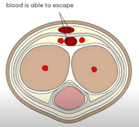 Cross section of penis - blood is able to escape