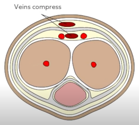 Cross section of penis - veins compress