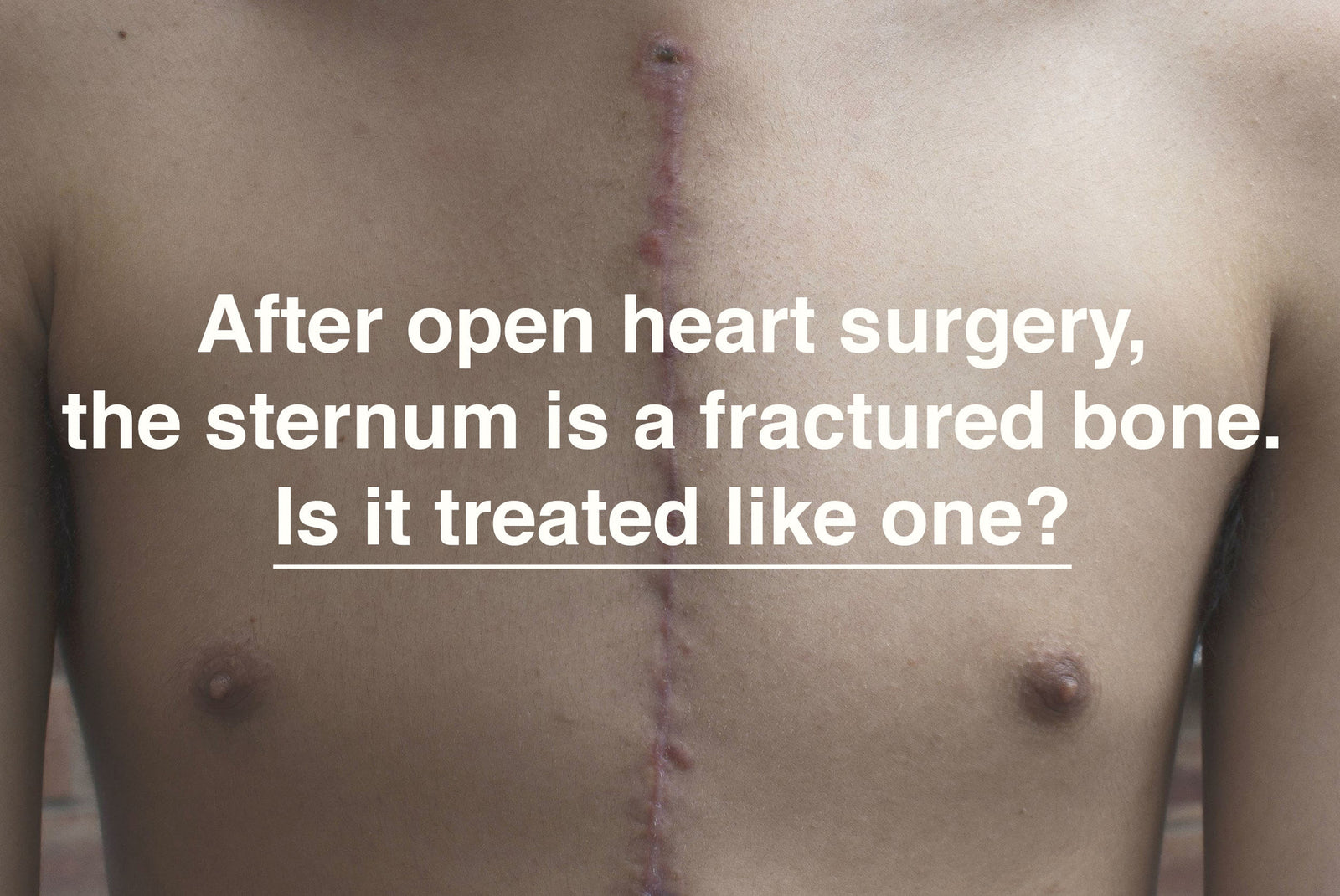 After Open Heart Surgery The Sternum Is A Fractured Bone Is It Treat