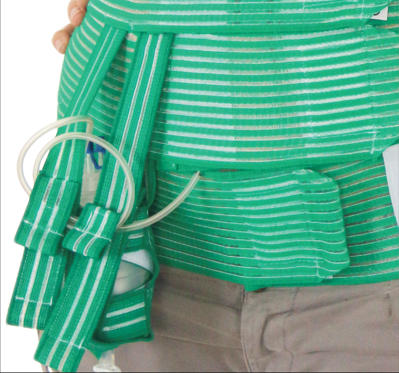 QualiBelly Advanced post surgery abdominal binder with drainage system