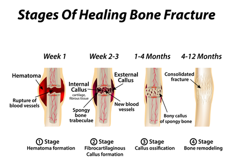 The healing process