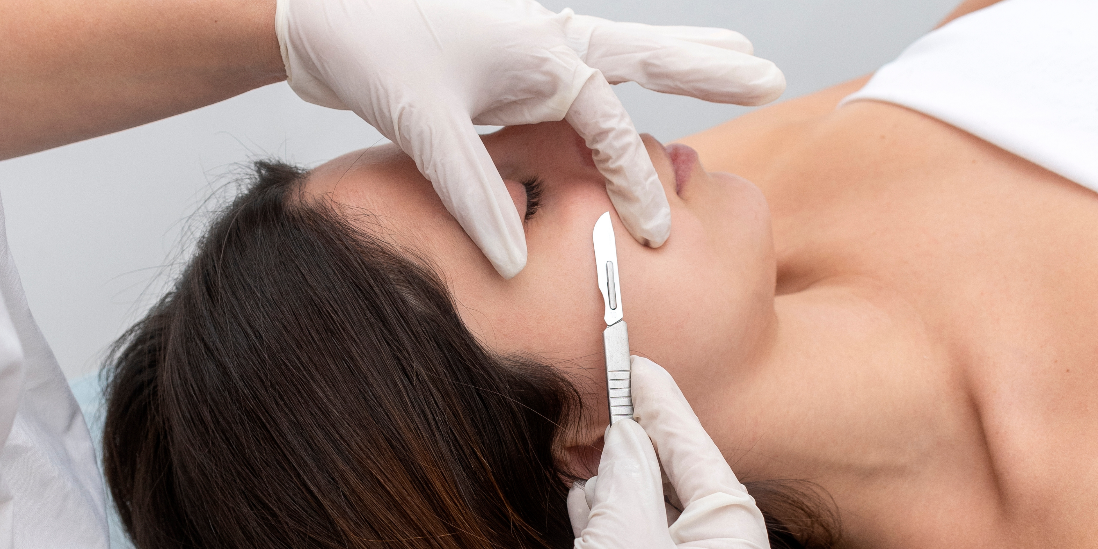 dermaplaning facial treatment 