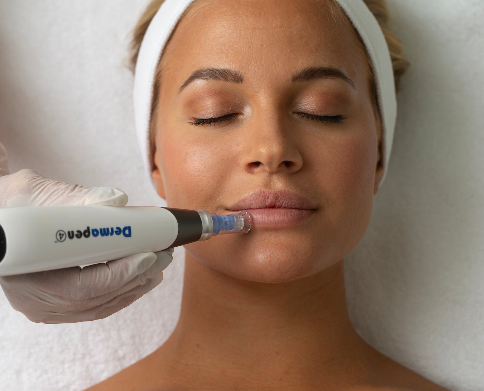 Dermapen Skin Needling