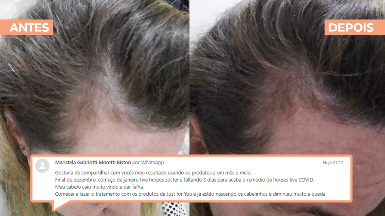 Imagem com depoimento de cliente sobre a sua queda de cabelo antes e depois