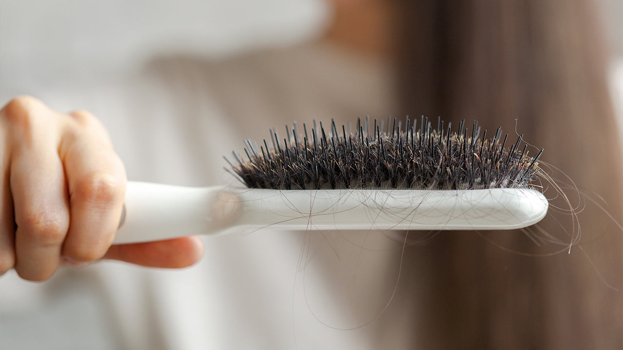 Mulher com alopecia segurando uma escova com fios de cabelo