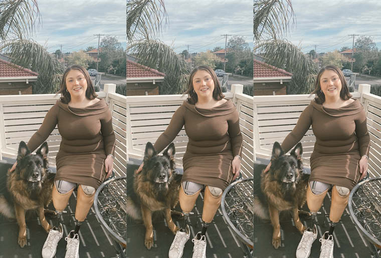 Lauren, a young woman with shoulder length brown hair is sitting on the patio with a dog at her side. She is wearing a body-con brown dress with white sneakers and two nude lower limb prosthetics.