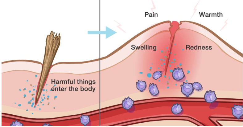 inflammation on the skin