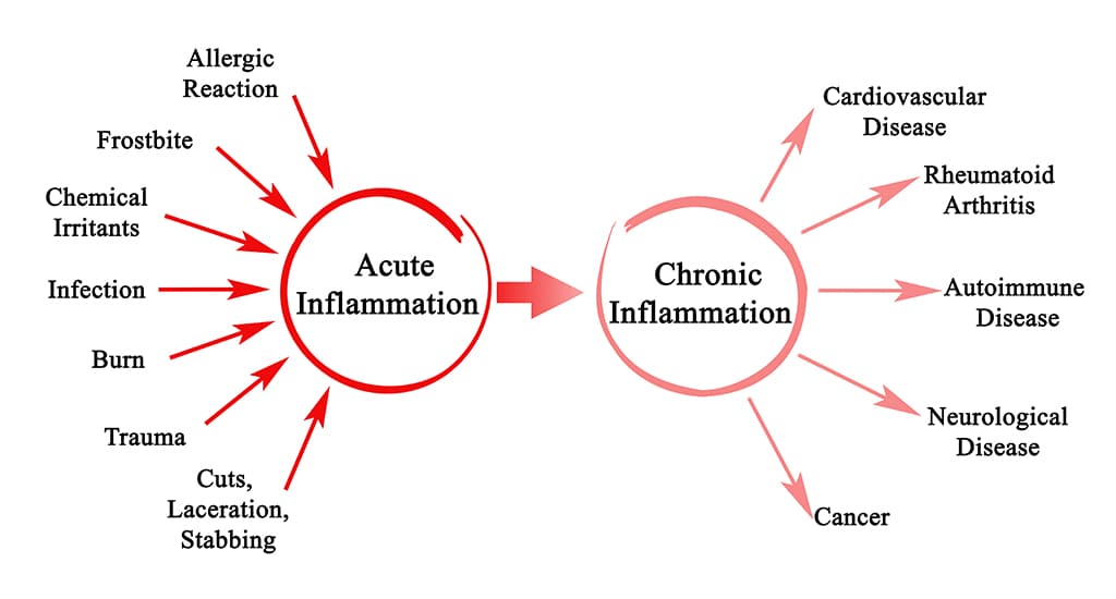 acute versus chronic inflammation probiotics informational