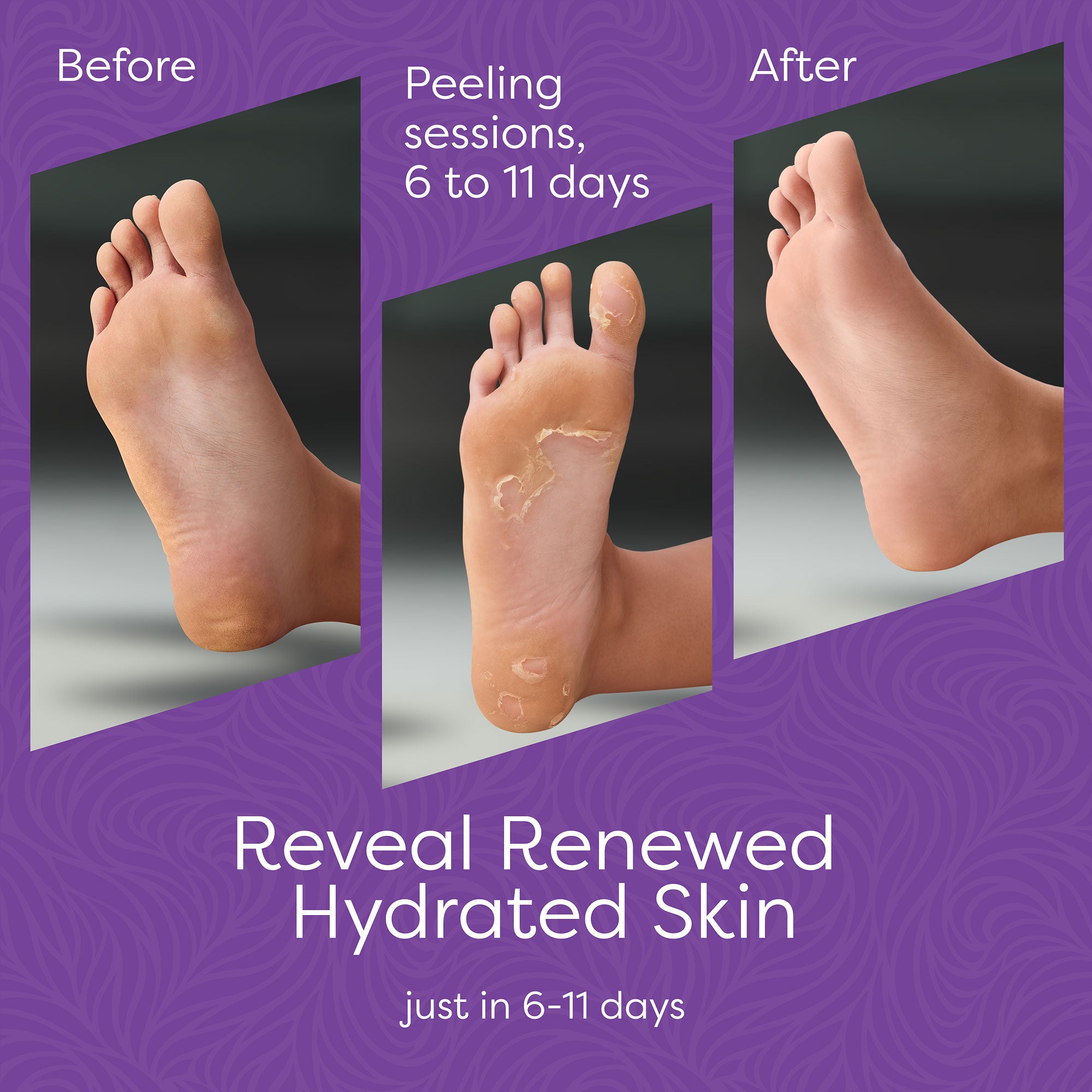 Aesta 3-in-1 Foot Peel Full-Cycle Foot Care: Revitalizing Mousse