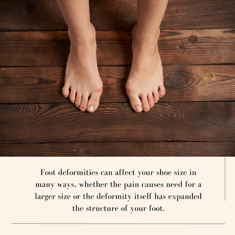 picture shows two feet with a foot deformity.