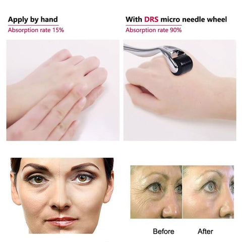 Derma Roller Microneedling Titanium 0.5 1.5mm Microneedle Face Dermaroller Stretch Marks 1 mm At Home Facial Micro Needle