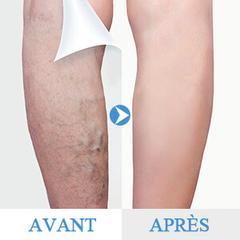 VariStop : creme anti varicosités