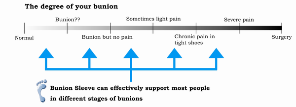 Bunion Sleeve: Bunion Severity Chart