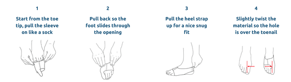 How To Wear Bunion Sleeve