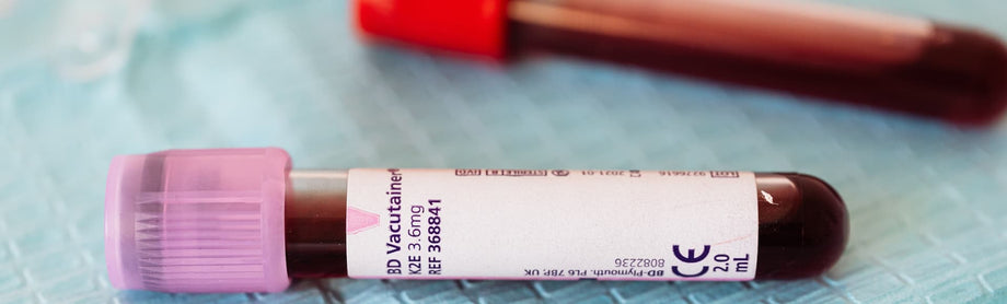 Image of blood in vials for test