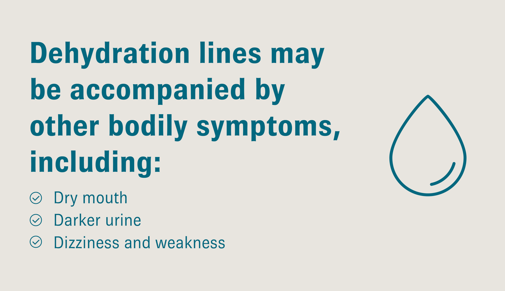 Graphic featuring a water droplet and text that reads, “Dehydration lines may be accompanied by other bodily symptoms, including: Dry mouth; Darker urine; Dizziness and weakness”.