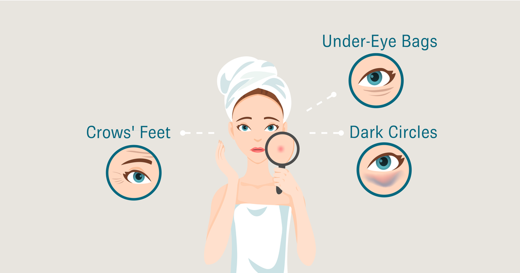 Illustration of a woman in a towel holding a magnifying glass to her face with three zoomed-in circles that show crow’s feet, under-eye bags, and dark-circles and are labeled as such.