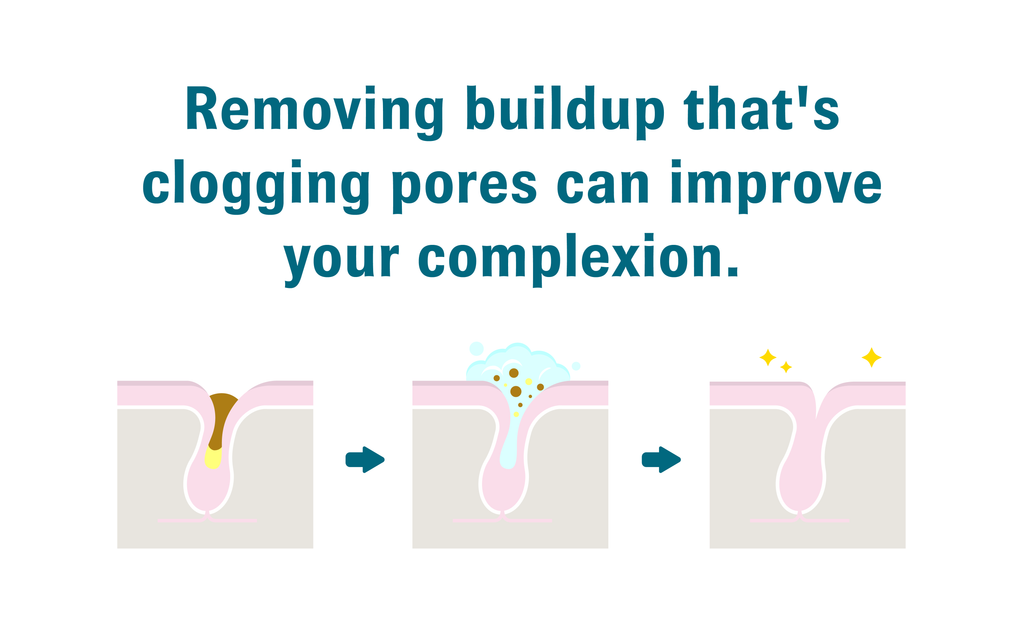 Diagrams showing clogged pores, pores during face wash, and pore after it’s cleansed with text above that reads, “Removing buildup that's clogging pores can improve your complexion.”