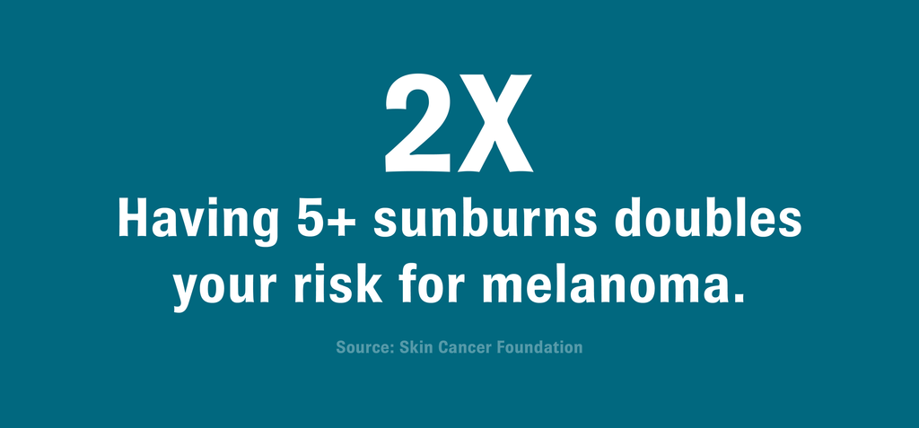 Graphic featuring an enlarged “2X” and text that reads, “Having 5+ sunburns doubles your risk for melanoma. Source: Skin Cancer Foundation”.