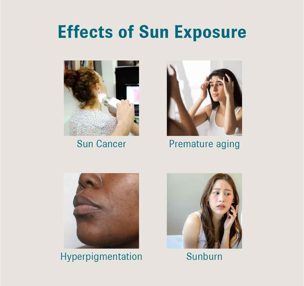 Graphic titled, “Effects of Sun Exposure” and four images depicting: sun cancer, premature aging, hyperpigmentation, and sunburn.