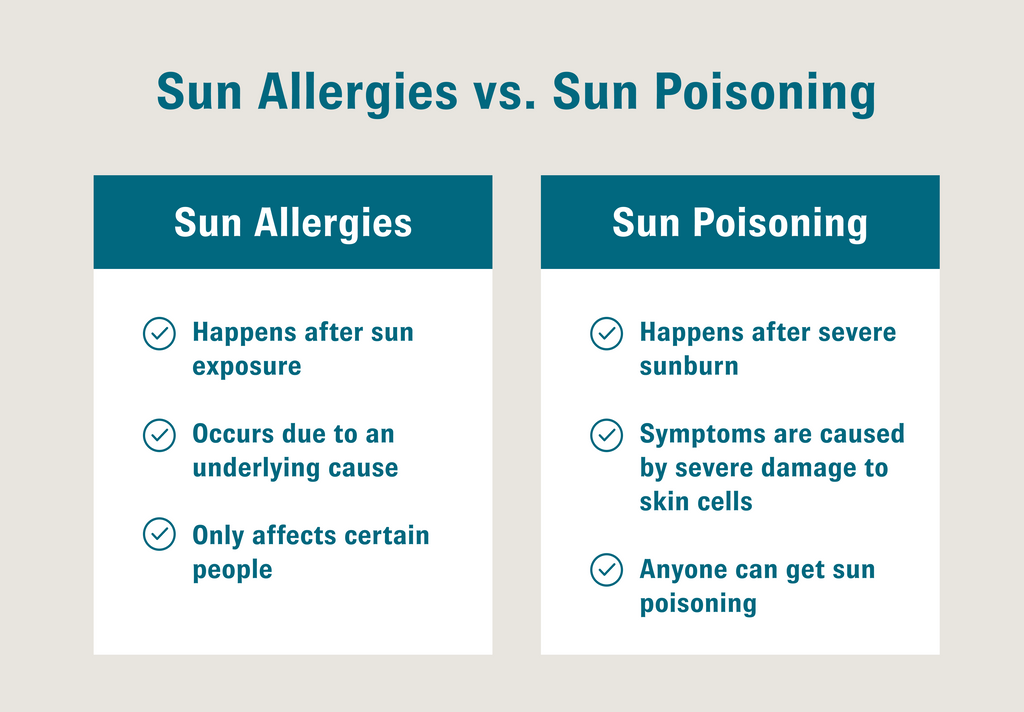 Sun allergies vs Sun poisoning symptoms