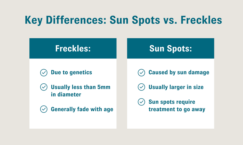 Sunspots vs freckles key differences explained.