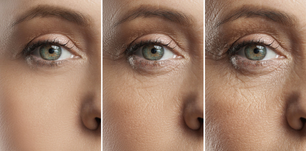 Image showing aging progression of skin around a woman’s eye.