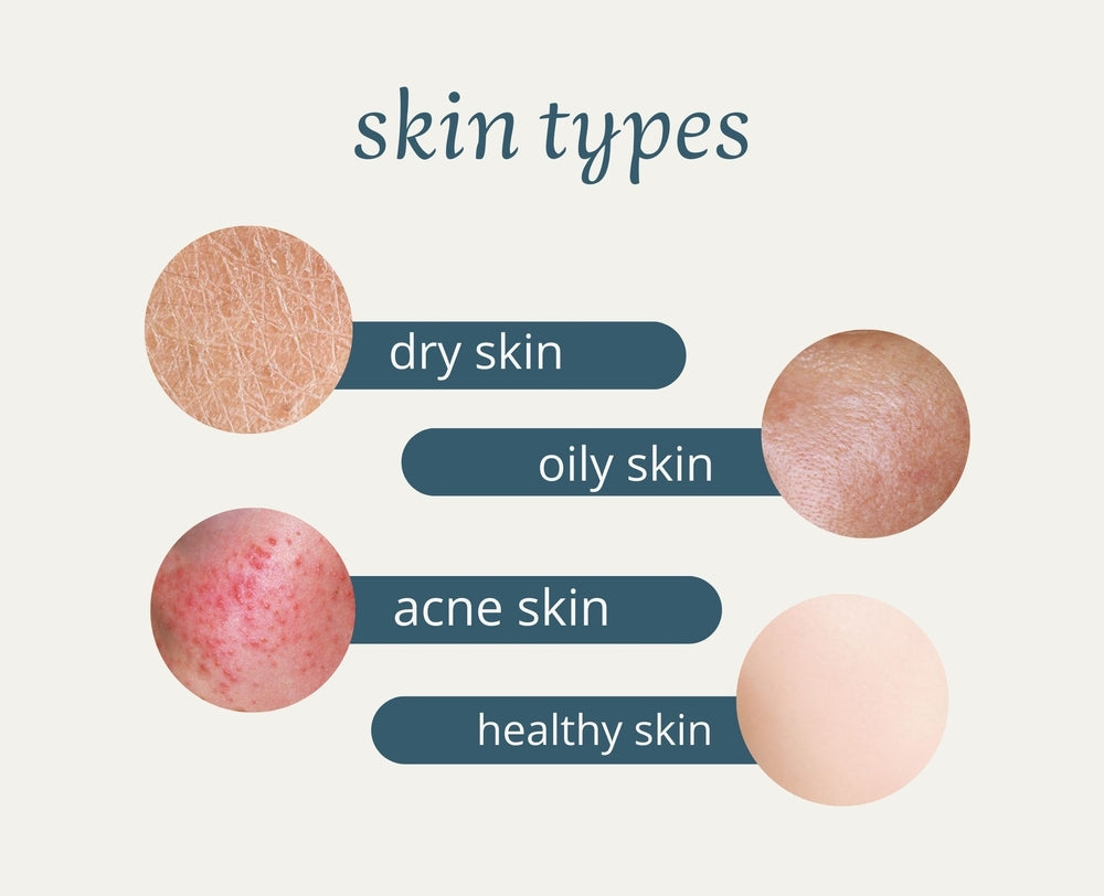 Image showing examples of dry, oily, acne, and healthy skin.