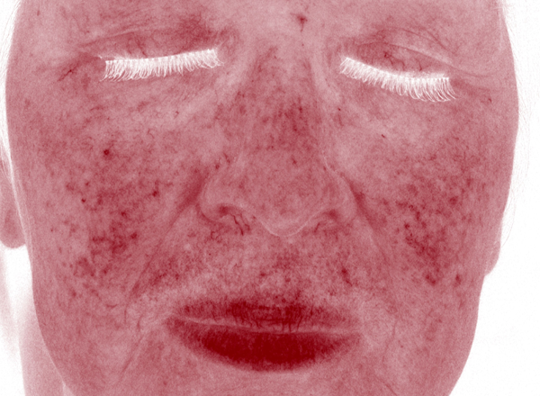 clinical study subject face scan - week 4, bare skin