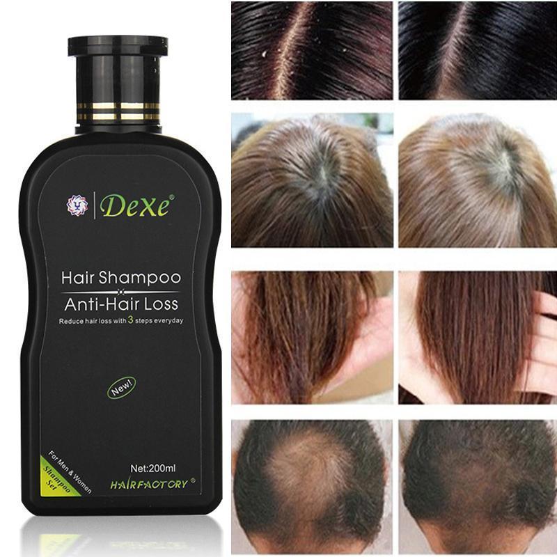 Shampoo Anti-hair Loss
